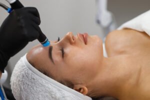 Hydrafacial Syndeo