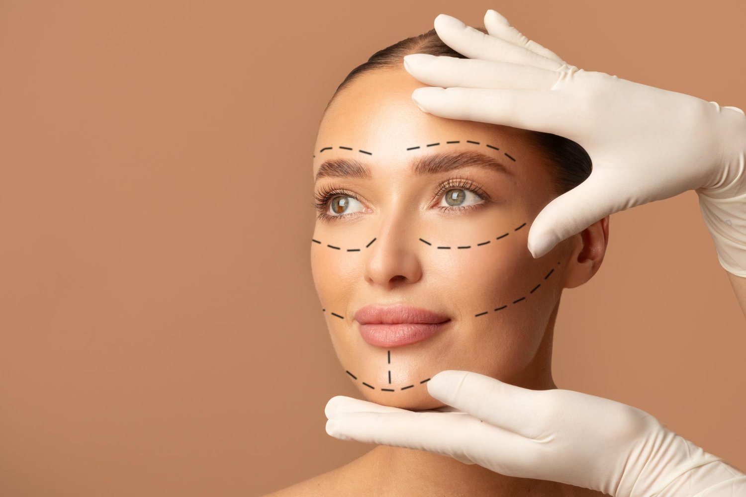 Ultherapy θεραπεία